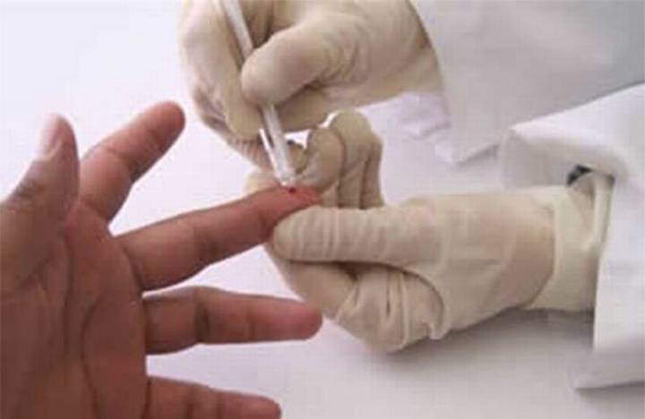 eliminar el VIH expresochiapas