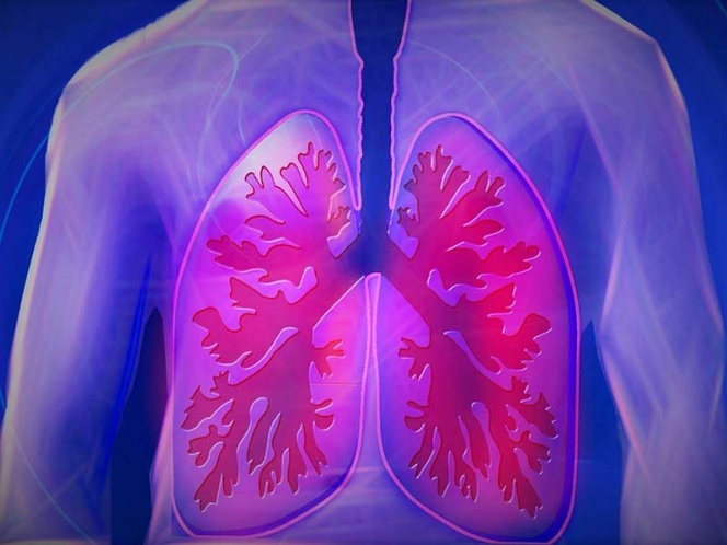 Prolonga nuevo tratamiento vida de pacientes con cáncer pulmonar expresochiapas