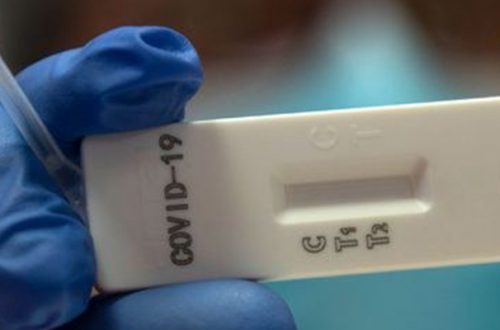 Un análisis genético de muestras de más de 7 mil 500 personas infectadas con Covid-19 sugiere que el nuevo coronavirus se propagó rápidamente por todo el mundo a fines del año pasado y se está adaptando a sus huéspedes humanos, dijeron científicos. La imagen, de una prueba en Roma. Foto Afp
