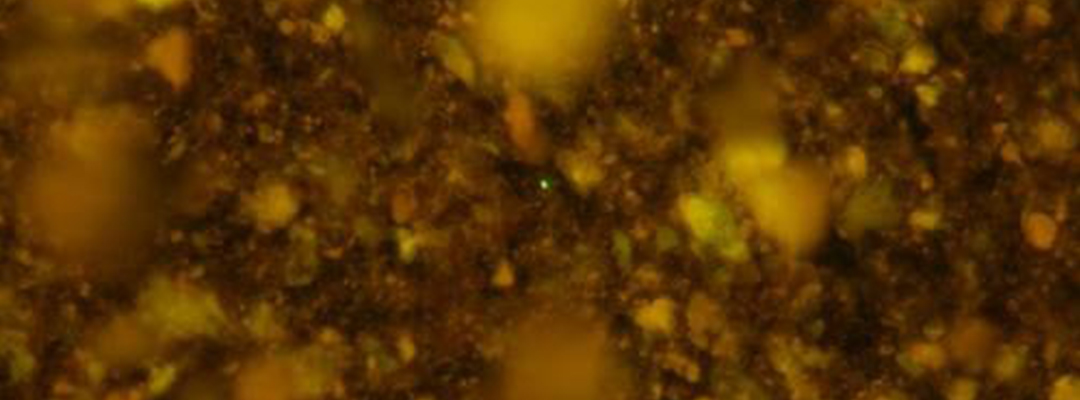 Imagen de microscopía de fluorescencia atrapada por membrana de las muestras antes de los procesos de purificación celular, donde se observaron partículas de sedimentos muy abundantes, en un ubicación no revelada. Foto Afp